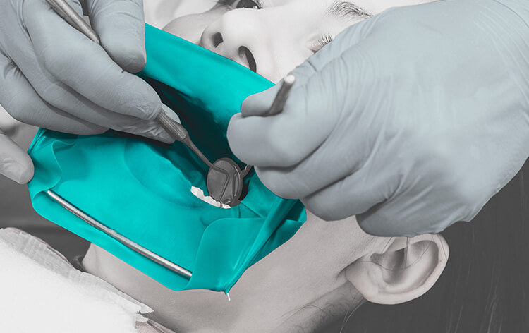 Exploring the Use of 100% Recyclable TPE Material in Dental Dam Applications